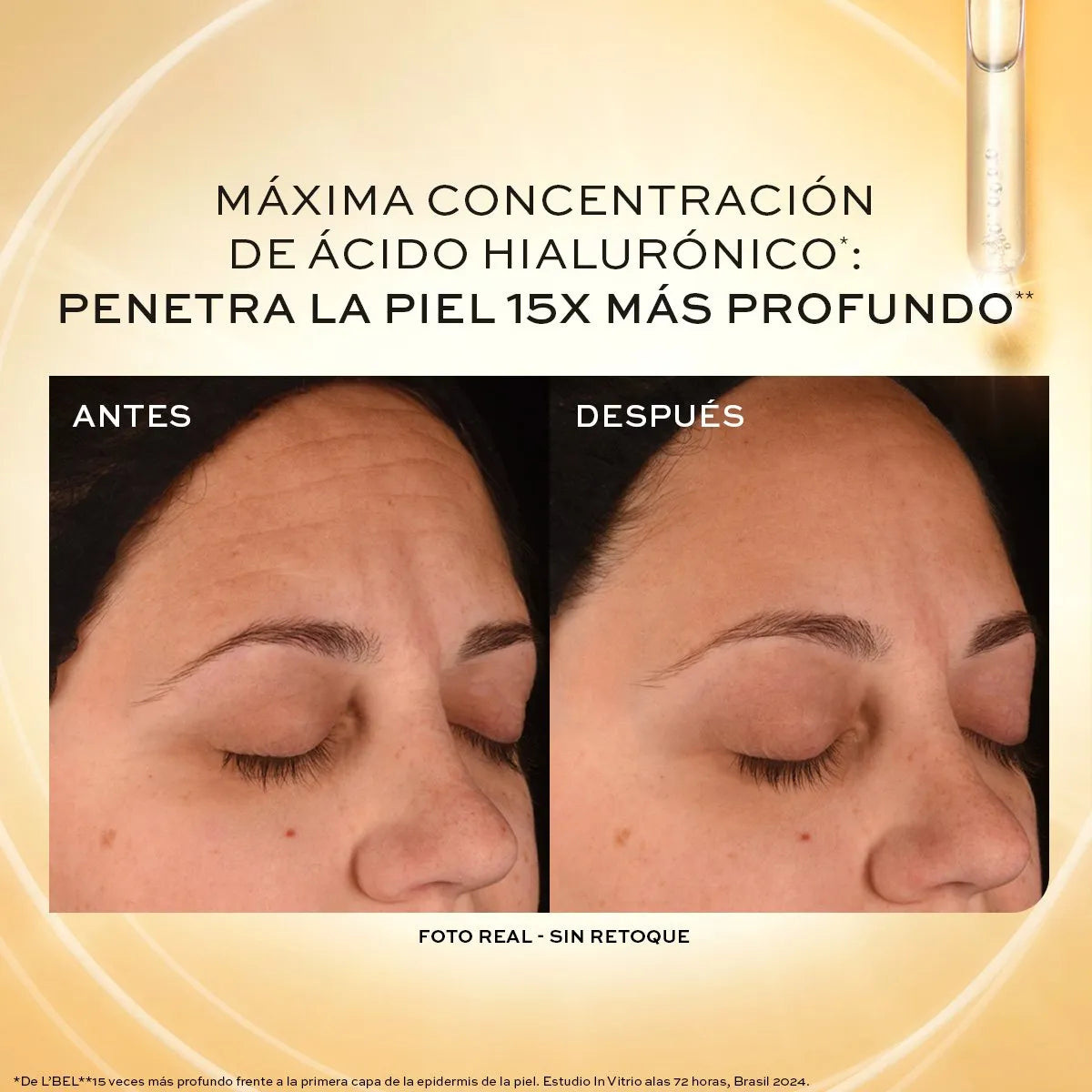 Suero Facial L'bel Hyaluronic Complex 30 Ml